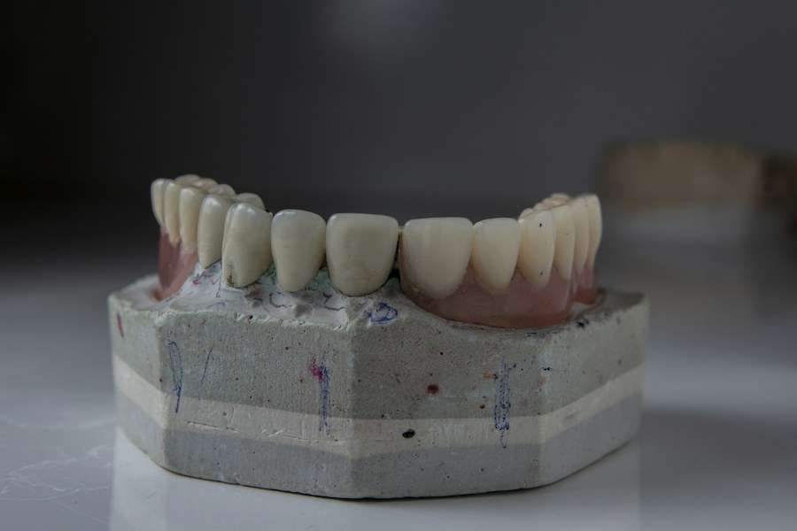 Modelo odontológico ilustrativo